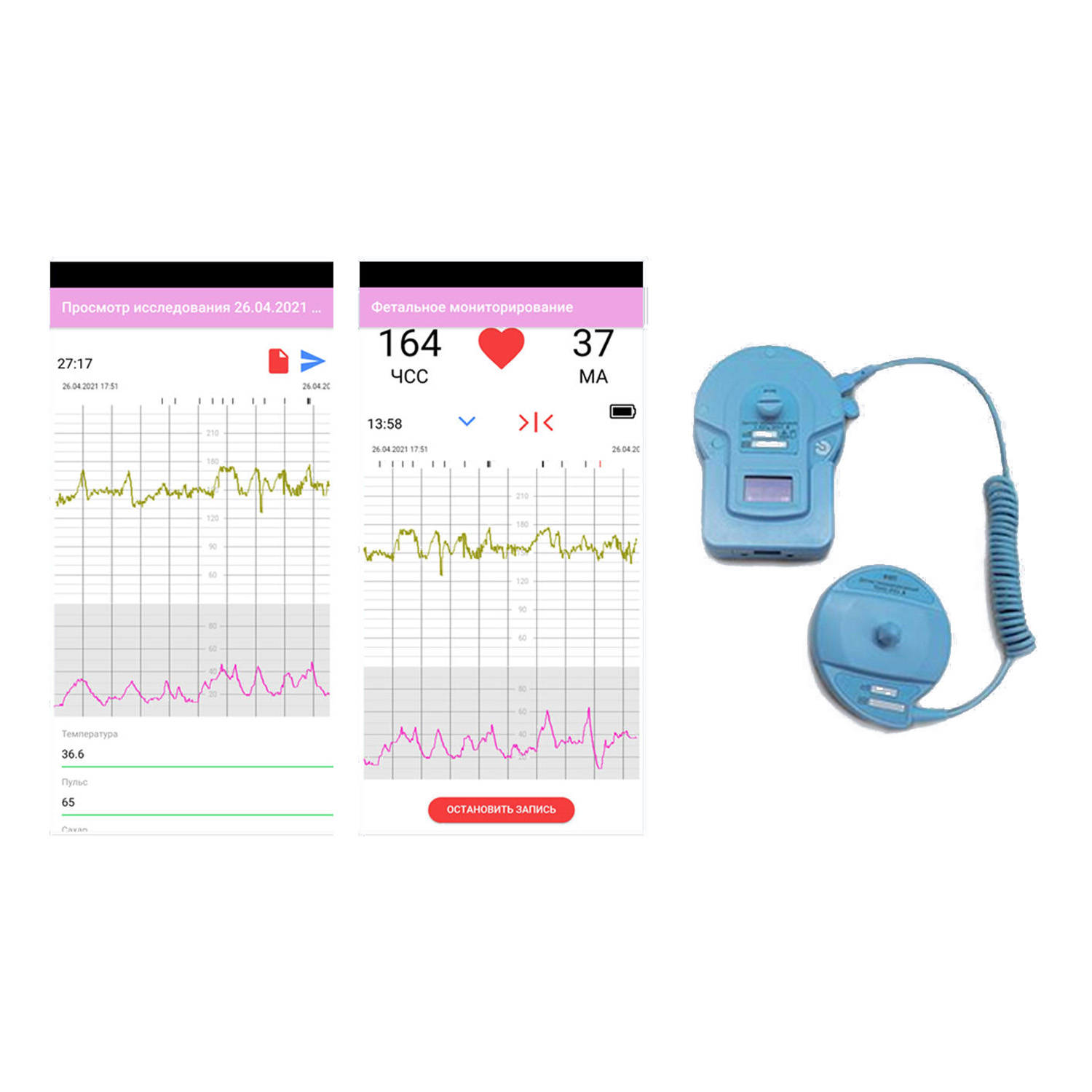 Система дистанционного кардиотокографического мониторирования ФМП — Сделано  в Москве — Сделано в Москве