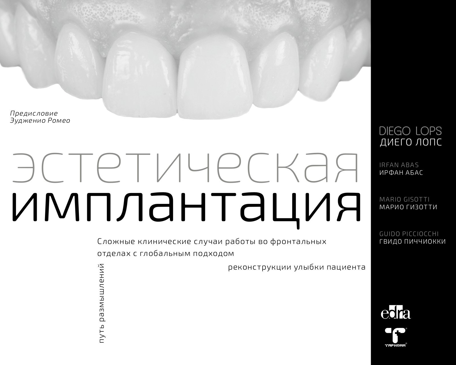 Эстетическая имплантация - Диего Лопс