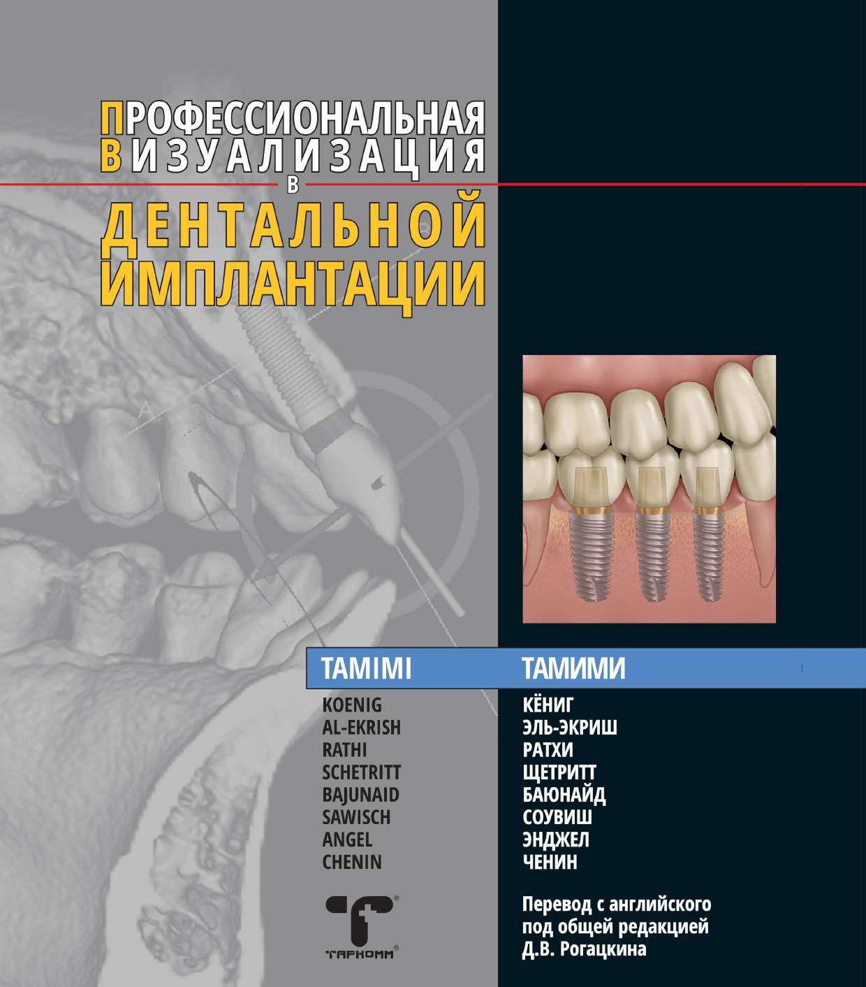 Профессиональная визуализация в дентальной имплантации