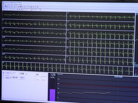 Медосмотр «Авангарда». День 1